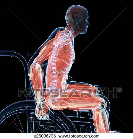 Stock Illustration - Man in a wheelchair, artwork. Fotosearch
