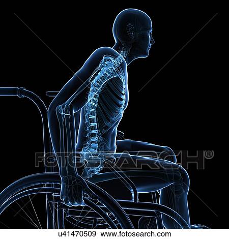 Stock Illustration - Man in a wheelchair, artwork. Fotosearch