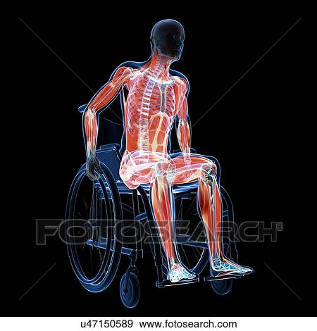 Stock Illustration - Man in a wheelchair, artwork. Fotosearch