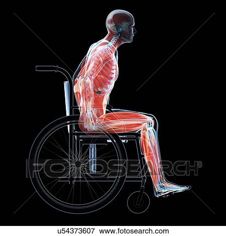 Stock Illustration - Man in a wheelchair, artwork. Fotosearch