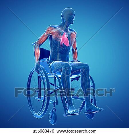 Stock Illustration - Man in a wheelchair, artwork. Fotosearch