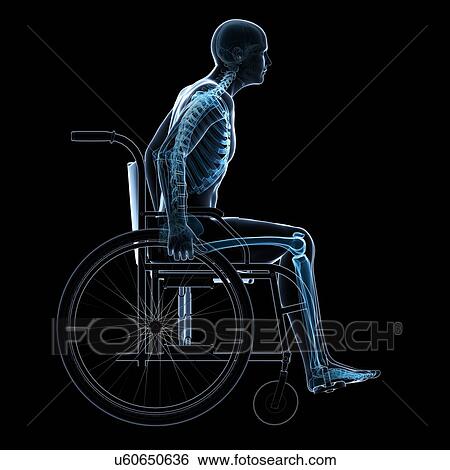 Stock Illustration - Man in a wheelchair, artwork. Fotosearch