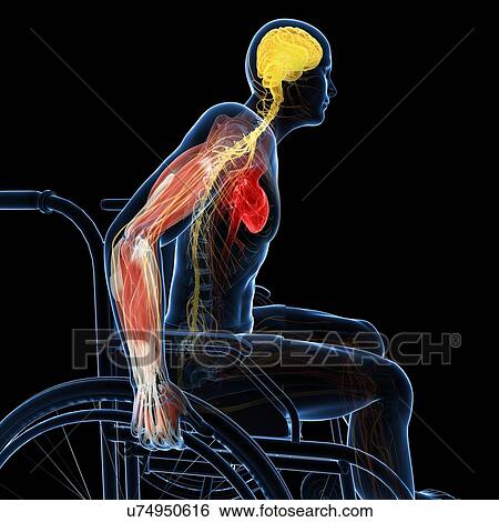Stock Illustration - Man in a wheelchair, artwork. Fotosearch