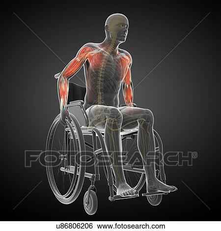 Man in a wheelchair, artwork View Large Illustration Stock Illustration - Man in a wheelchair, artwork. Fotosearch