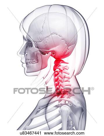 Neck pain, artwork View Large Illustration Clip Art - Neck pain, artwork. Fotosearch