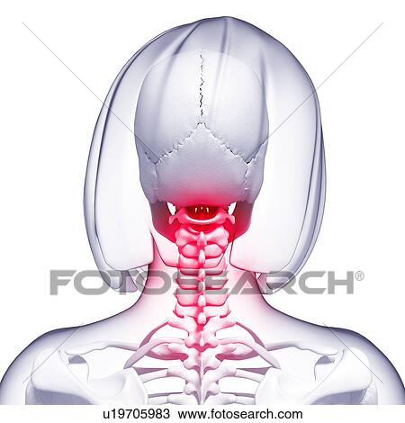 Neck pain, artwork View Large Illustration Drawing - Neck pain, artwork. Fotosearch