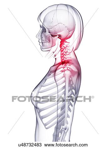 Neck pain, artwork View Large Illustration Drawing - Neck pain, artwork. Fotosearch