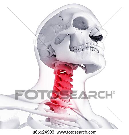 Neck pain, artwork View Large Illustration Drawing - Neck pain, artwork. Fotosearch