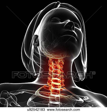 Neck pain, artwork View Large Illustration Drawing - Neck pain, artwork. Fotosearch