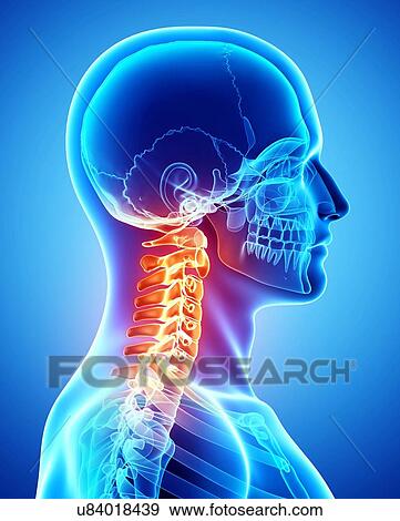 Neck pain, artwork View Large Illustration Stock Illustration - Neck pain, artwork. Fotosearch
