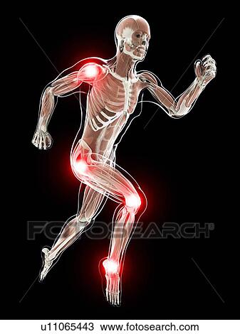 Painful joints, artwork View Large Illustration Drawing - Painful joints, artwork. Fotosearch