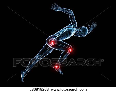 Painful joints, artwork View Large Illustration Drawing - Painful joints, artwork. Fotosearch