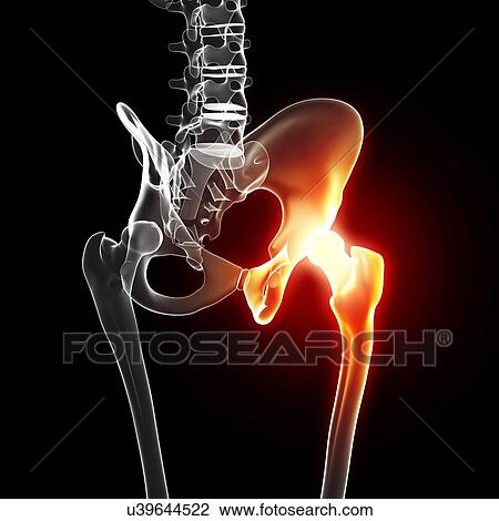 Pelvic pain, artwork View Large Illustration Drawing - Pelvic pain, artwork. Fotosearch