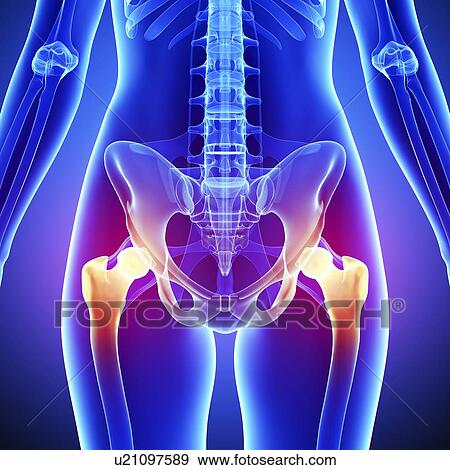 Pelvic pain, artwork View Large Illustration Stock Illustration - Pelvic pain, artwork. Fotosearch