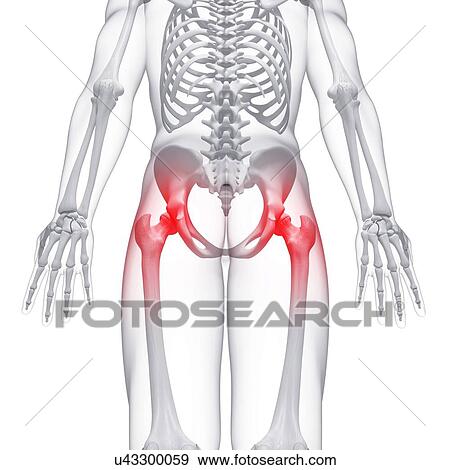 Stock Illustration - Pelvic pain, artwork. Fotosearch