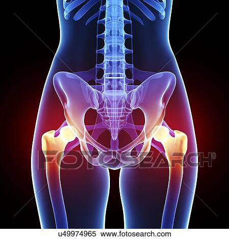 Pelvic pain, artwork View Large Illustration Stock Illustration - Pelvic pain, artwork. Fotosearch