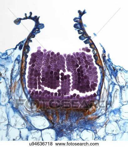 Rust fungus spore, light micrograph View Large Illustration Stock Illustration - Rust fungus spore, light micrograph. Fotosearch