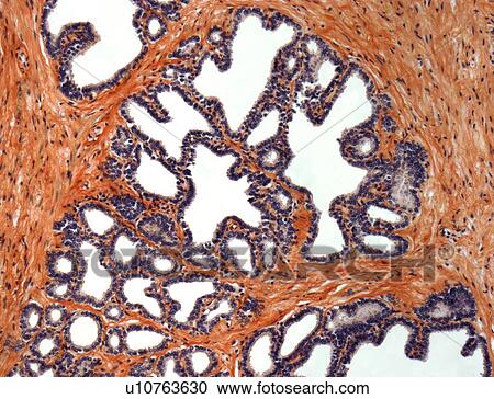 Clipart - Seminal vesicle, light micrograph. Fotosearch