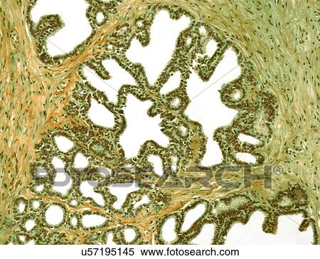 Stock Illustration - Seminal vesicle, light micrograph. Fotosearch