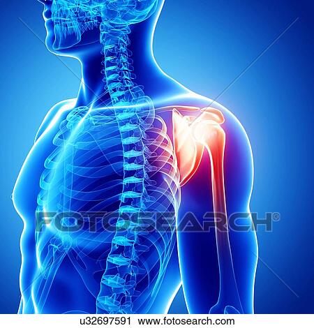 Shoulder pain, artwork View Large Illustration Clip Art - Shoulder pain, artwork. Fotosearch