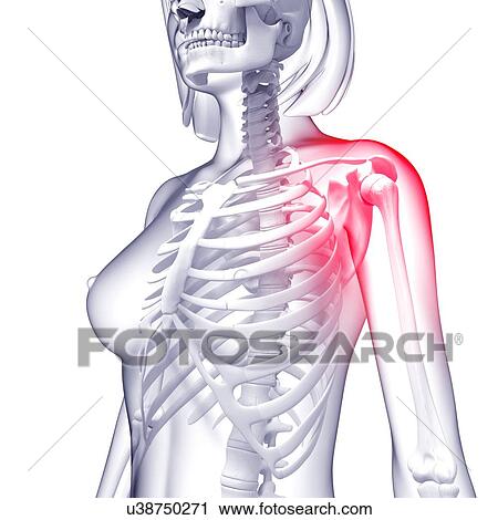 Clip Art - Shoulder pain, artwork. Fotosearch