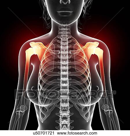 Shoulder pain, artwork View Large Illustration Clip Art - Shoulder pain, artwork. Fotosearch