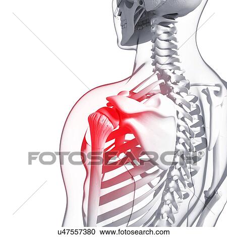 Clipart - Shoulder pain, artwork. Fotosearch