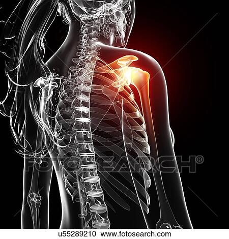 Shoulder pain, artwork View Large Illustration Clipart - Shoulder pain, artwork. Fotosearch