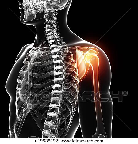 Shoulder pain, artwork Drawing | u19535192 | Fotosearch