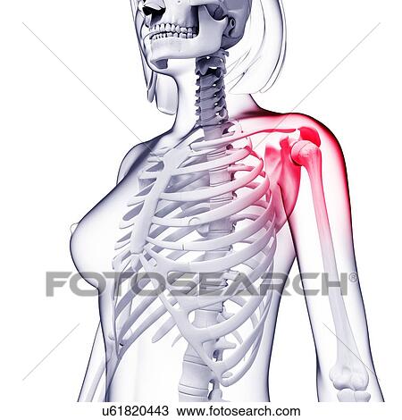 Shoulder pain, artwork View Large Illustration Drawing - Shoulder pain, artwork. Fotosearch