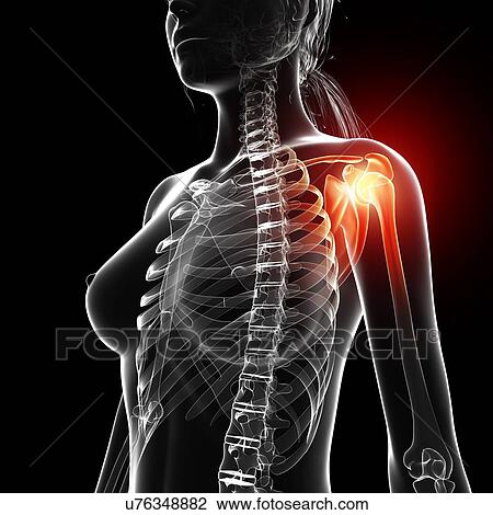 Drawing - Shoulder pain, artwork. Fotosearch
