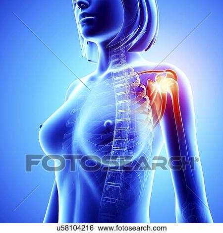 Shoulder pain, artwork View Large Illustration Stock Illustration - Shoulder pain, artwork. Fotosearch