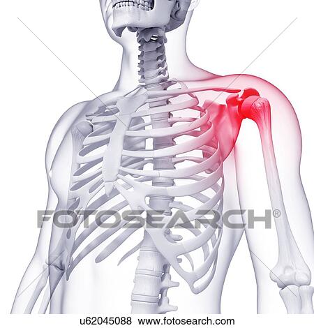 Shoulder pain, artwork View Large Illustration Stock Illustration - Shoulder pain, artwork. Fotosearch