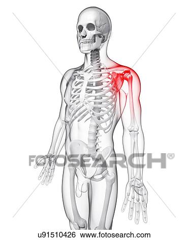 Shoulder pain, artwork View Large Illustration Stock Illustration - Shoulder pain, artwork. Fotosearch