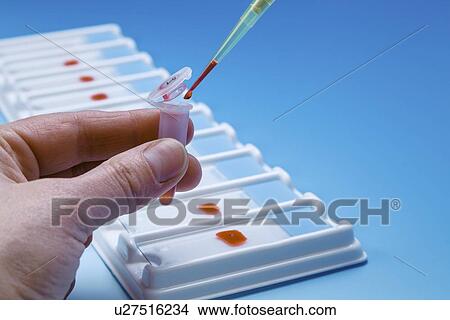 Slide preparation View Large Illustration Stock Illustration - Slide preparation. Fotosearch