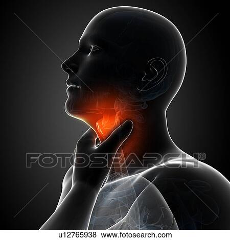 Sore throat, artwork View Large Illustration Stock Illustration - Sore throat, artwork. Fotosearch