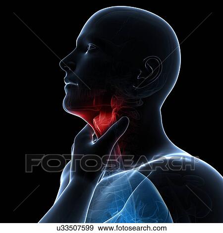 Sore throat, artwork View Large Illustration Stock Illustration - Sore throat, artwork. Fotosearch