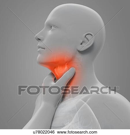 Sore throat, artwork View Large Illustration Stock Illustration - Sore throat, artwork. Fotosearch