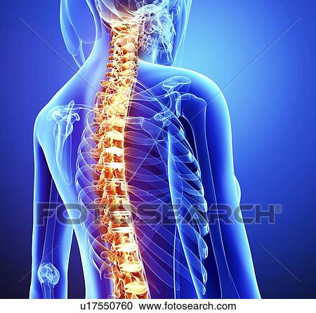 Spine pain, artwork View Large Illustration Clipart - Spine pain, artwork. Fotosearch