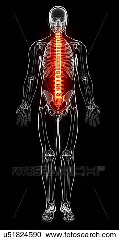 Spine pain, artwork View Large Illustration Clipart - Spine pain, artwork. Fotosearch