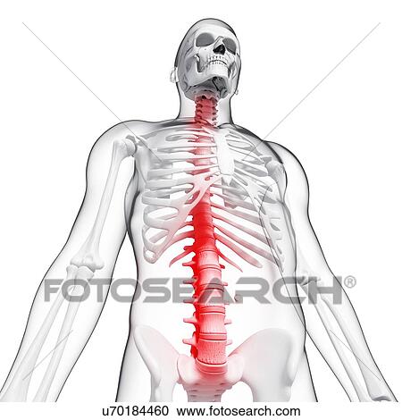 Clipart - Spine pain, artwork. Fotosearch