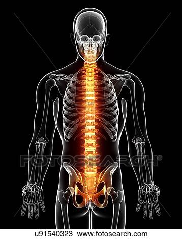 Spine pain, artwork View Large Illustration Drawing - Spine pain, artwork. Fotosearch