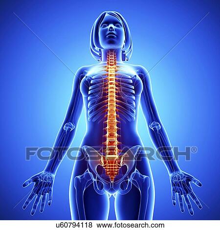 Spine pain, artwork View Large Illustration Stock Illustration - Spine pain, artwork. Fotosearch