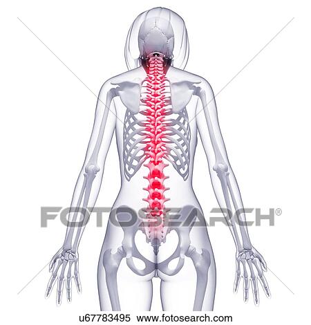 Spine pain, artwork View Large Illustration Stock Illustration - Spine pain, artwork. Fotosearch