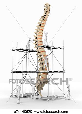 Clipart - Spine with workers, spine repair. Fotosearch