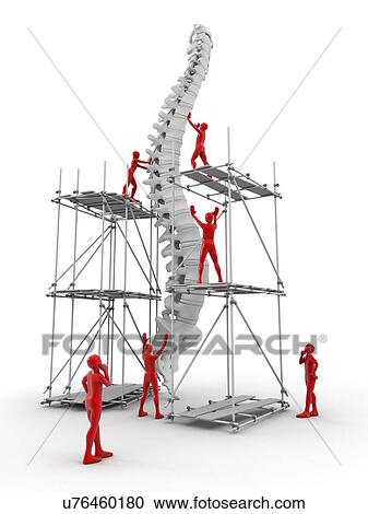 Spine with workers, spine repair View Large Illustration Clipart - Spine with workers, spine repair. Fotosearch