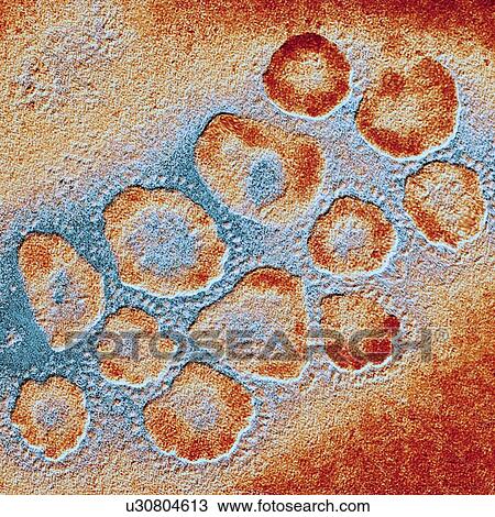 Drawing - TEM of a cluster of corona viruses. Fotosearch