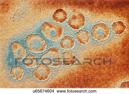 Stock Illustration - TEM of a cluster of corona viruses. Fotosearch