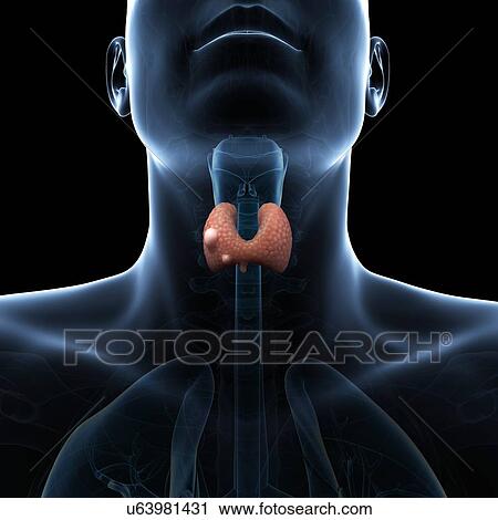 Thyroid gland cancer, artwork View Large Illustration Clip Art - Thyroid gland cancer, artwork. Fotosearch