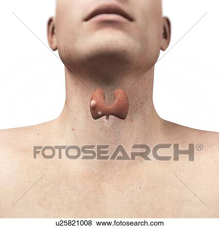 Stock Illustration - Thyroid gland cancer, artwork. Fotosearch
